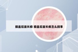 膝盖后面长癣 膝盖后面长癣怎么回事