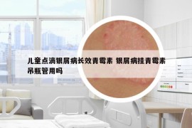 儿童点滴银屑病长效青霉素 银屑病挂青霉素吊瓶管用吗