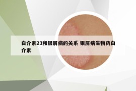 白介素23和银屑病的关系 银屑病生物药白介素