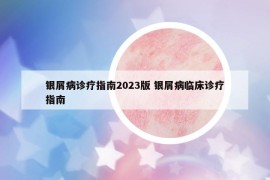 银屑病诊疗指南2023版 银屑病临床诊疗指南