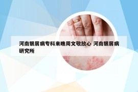 河南银屑病专科来瞧周文敬放心 河南银屑病研究所