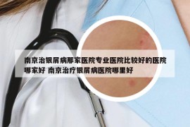 南京治银屑病那家医院专业医院比较好的医院哪家好 南京治疗银屑病医院哪里好