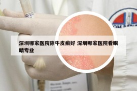 深圳哪家医院除牛皮癣好 深圳哪家医院看眼睛专业