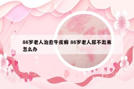 86岁老人治愈牛皮癣 86岁老人尿不出来怎么办