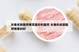 长春皮肤医院哪家最好的医院 长春的皮肤医院哪里的好