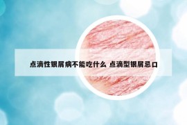 点滴性银屑病不能吃什么 点滴型银屑忌口