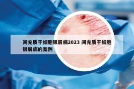 间充质干细胞银屑病2023 间充质干细胞银屑病的案例