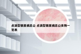 点滴型银屑病忌口 点滴型银屑病忌口食物一览表