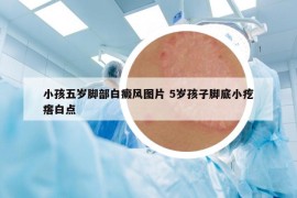 小孩五岁脚部白癜风图片 5岁孩子脚底小疙瘩白点