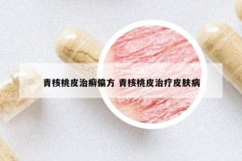 青核桃皮治癣偏方 青核桃皮治疗皮肤病