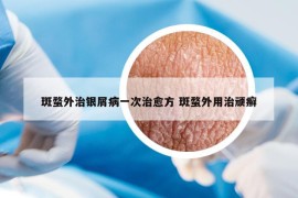 斑蝥外治银屑病一次治愈方 斑蝥外用治顽癣