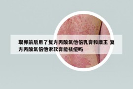 取卵前后用了复方丙酸氯他倍乳膏和康王 复方丙酸氯倍他索软膏能祛痘吗