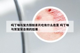 吗丁啉与复方胺肽素片吃有什么危害 吗丁啉与胃复安合用的后果