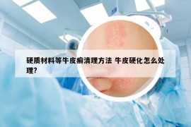 硬质材料等牛皮癣清理方法 牛皮硬化怎么处理?