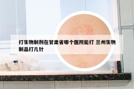 打生物制剂在甘肃省哪个医院能打 兰州生物制品打几针