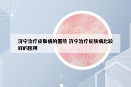 济宁治疗皮肤病的医院 济宁治疗皮肤病比较好的医院