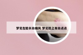 梦见左脸长白癜风 梦见脸上有白点点