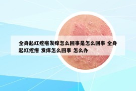 全身起红疙瘩发痒怎么回事是怎么回事 全身起红疙瘩 发痒怎么回事 怎么办