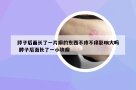 脖子后面长了一片癣的东西不疼不痒影响大吗 脖子后面长了一小块癣