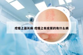 疙瘩上面长癣 疙瘩上有皮屑的有什么病