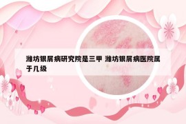 潍坊银屑病研究院是三甲 潍坊银屑病医院属于几级