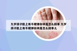 九岁孩子脸上有不规律白块是怎么回事 九岁孩子脸上有不规律白块是怎么回事儿