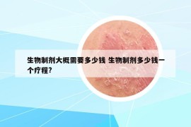 生物制剂大概需要多少钱 生物制剂多少钱一个疗程?