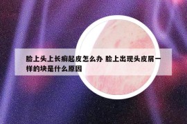 脸上头上长癣起皮怎么办 脸上出现头皮屑一样的块是什么原因