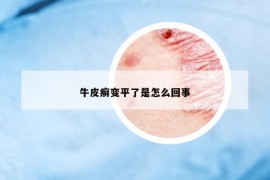 牛皮癣变平了是怎么回事