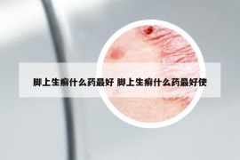 脚上生癣什么药最好 脚上生癣什么药最好使