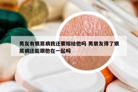 男友有银屑病我还要嫁给他吗 男朋友得了银屑病还能跟他在一起吗