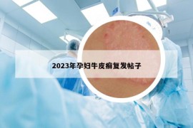 2023年孕妇牛皮癣复发帖子