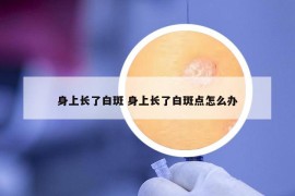 身上长了白斑 身上长了白斑点怎么办