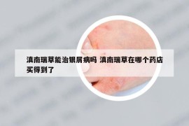 滇南瑞草能治银屑病吗 滇南瑞草在哪个药店买得到了