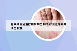 薏米红豆汤治疗银屑病怎么样 红豆薏米银耳汤怎么煮