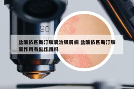 盐酸依匹斯汀胶囊治银屑病 盐酸依匹斯汀胶囊作用有副作用吗