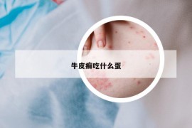 牛皮癣吃什么蛋