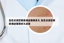 急性点滴型银屑病进展期多久 急性点滴型银屑病进展期多久结束