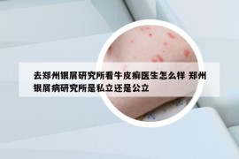 去郑州银屑研究所看牛皮癣医生怎么样 郑州银屑病研究所是私立还是公立