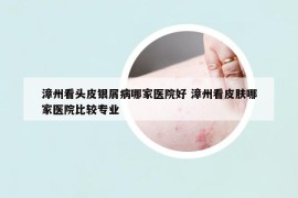 漳州看头皮银屑病哪家医院好 漳州看皮肤哪家医院比较专业