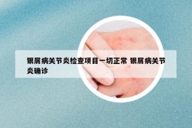 银屑病关节炎检查项目一切正常 银屑病关节炎确诊