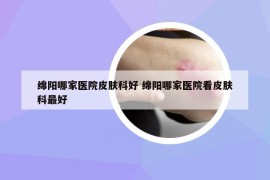 绵阳哪家医院皮肤科好 绵阳哪家医院看皮肤科最好