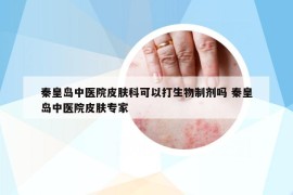 秦皇岛中医院皮肤科可以打生物制剂吗 秦皇岛中医院皮肤专家