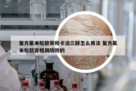 复方氟米松软膏和卡泊三醇怎么用法 复方氟米松软膏相同功效的