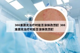 308准激光治疗时能否涂抹孜然酊 308准激光治疗时能否涂抹孜然酊