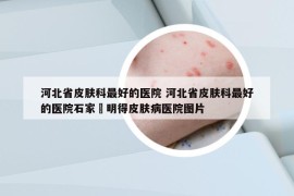 河北省皮肤科最好的医院 河北省皮肤科最好的医院石家庒明得皮肤病医院图片