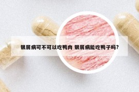 银屑病可不可以吃鸭肉 银屑病能吃鸭子吗?