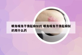 眼角嘴角干像起癣似的 眼角嘴角干像起癣似的用什么药