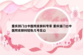 重庆到门口中医院皮肤科专家 重庆道门口中医院皮肤科轻轨几号出口