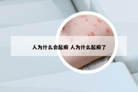 人为什么会起癣 人为什么起癣了